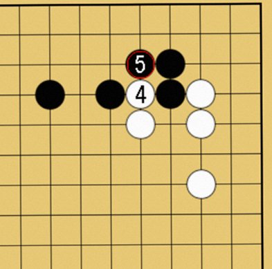 愚形といわれる理由と二立三析も学べる記事の説明図